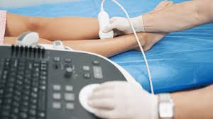 Doppler Ultrasound