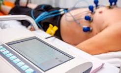 ECG